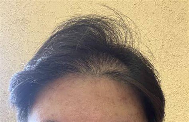 Having a visible scalp