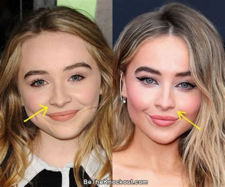 Unveiling The Truth: Has Sabrina Carpenter Had Work Done?